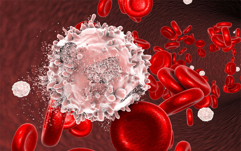 سرطان خون چیست + شایع ترین علائم سرطان خون زنان و مردان